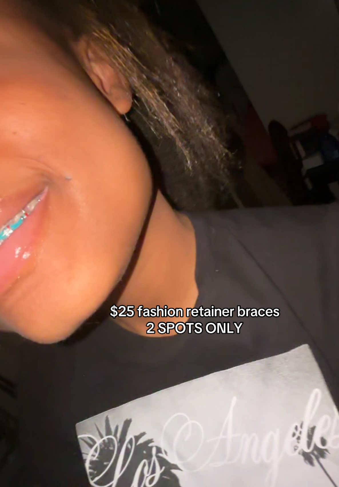 @THE FASHION BRACES GIRL🫧 🦷