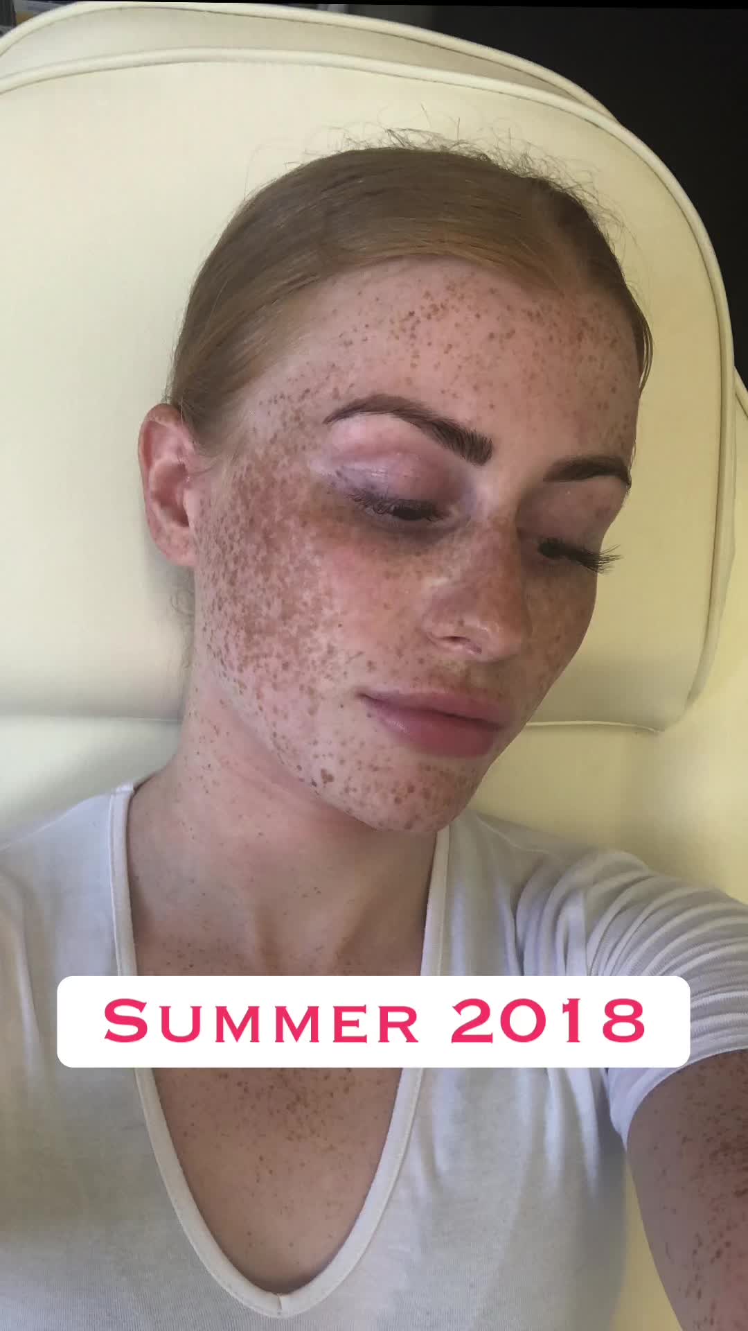 @my journey to repair my skin