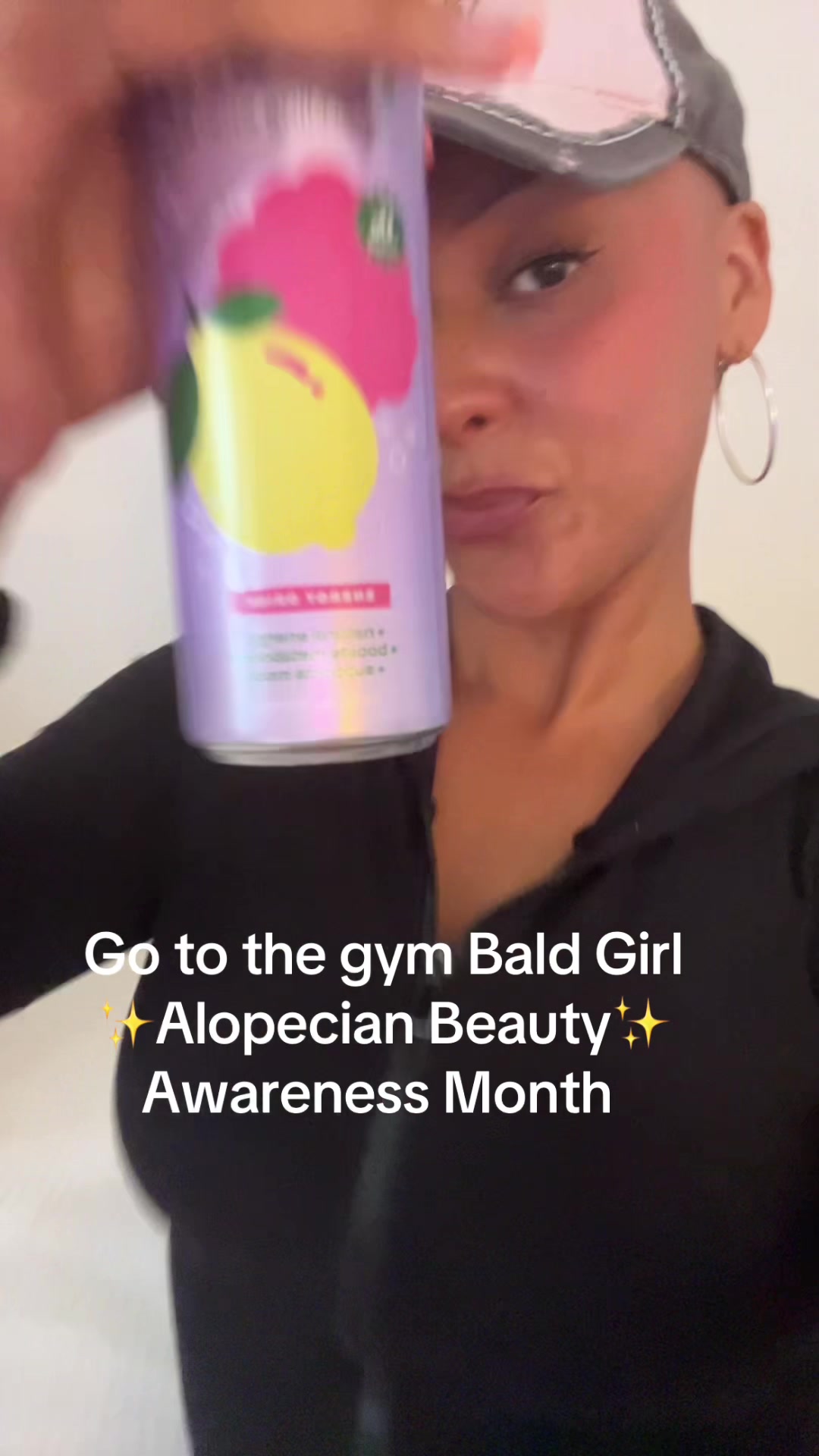 @AlopecianPrincess