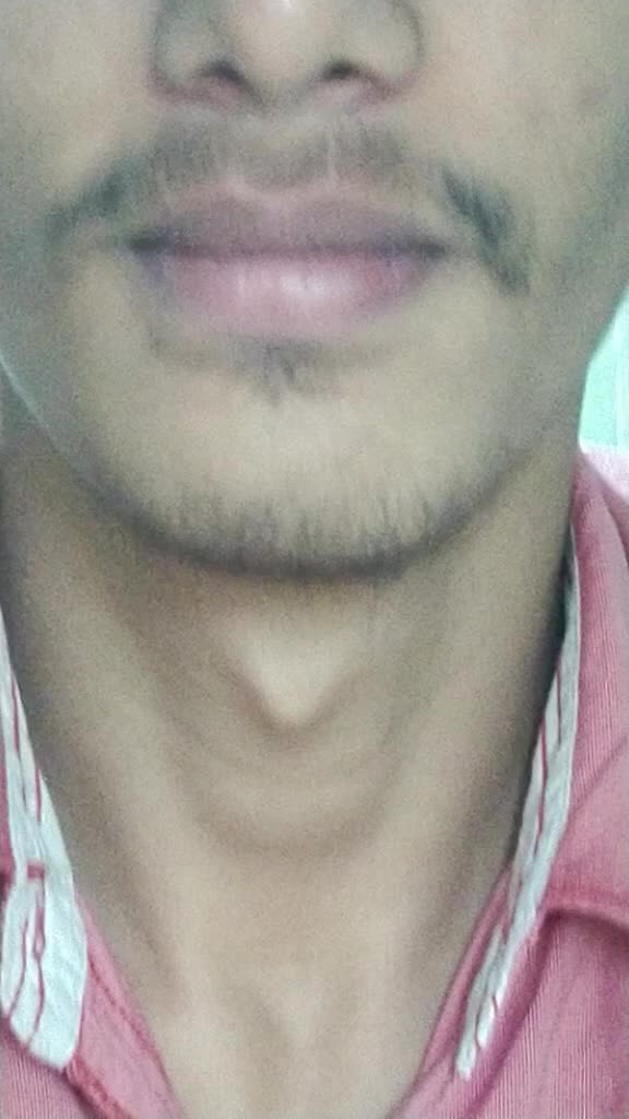 @Lips KingMaker 1