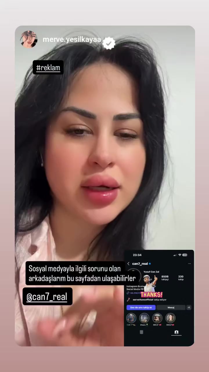 @CAN REAL