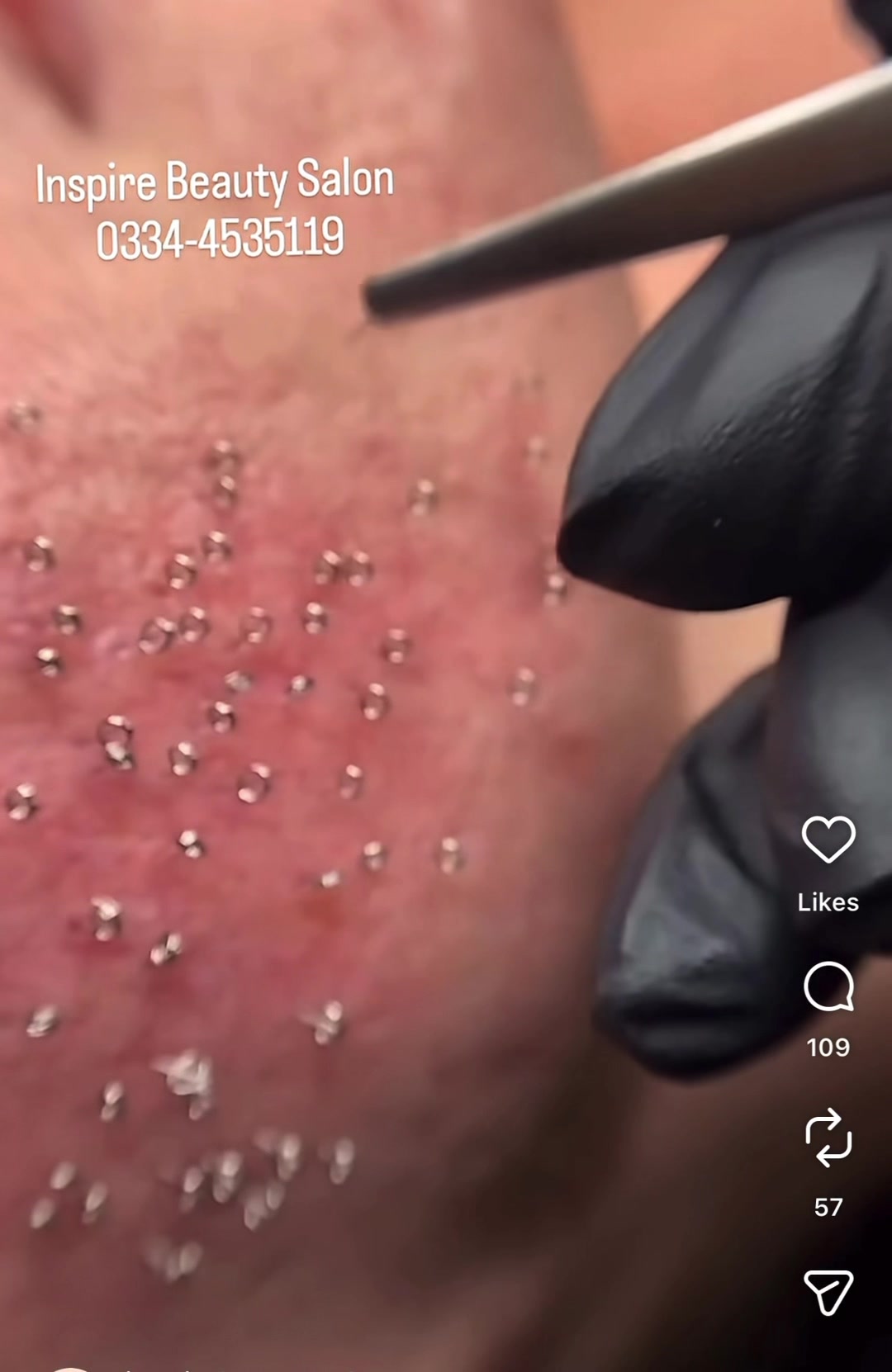 @Pure Skin OC