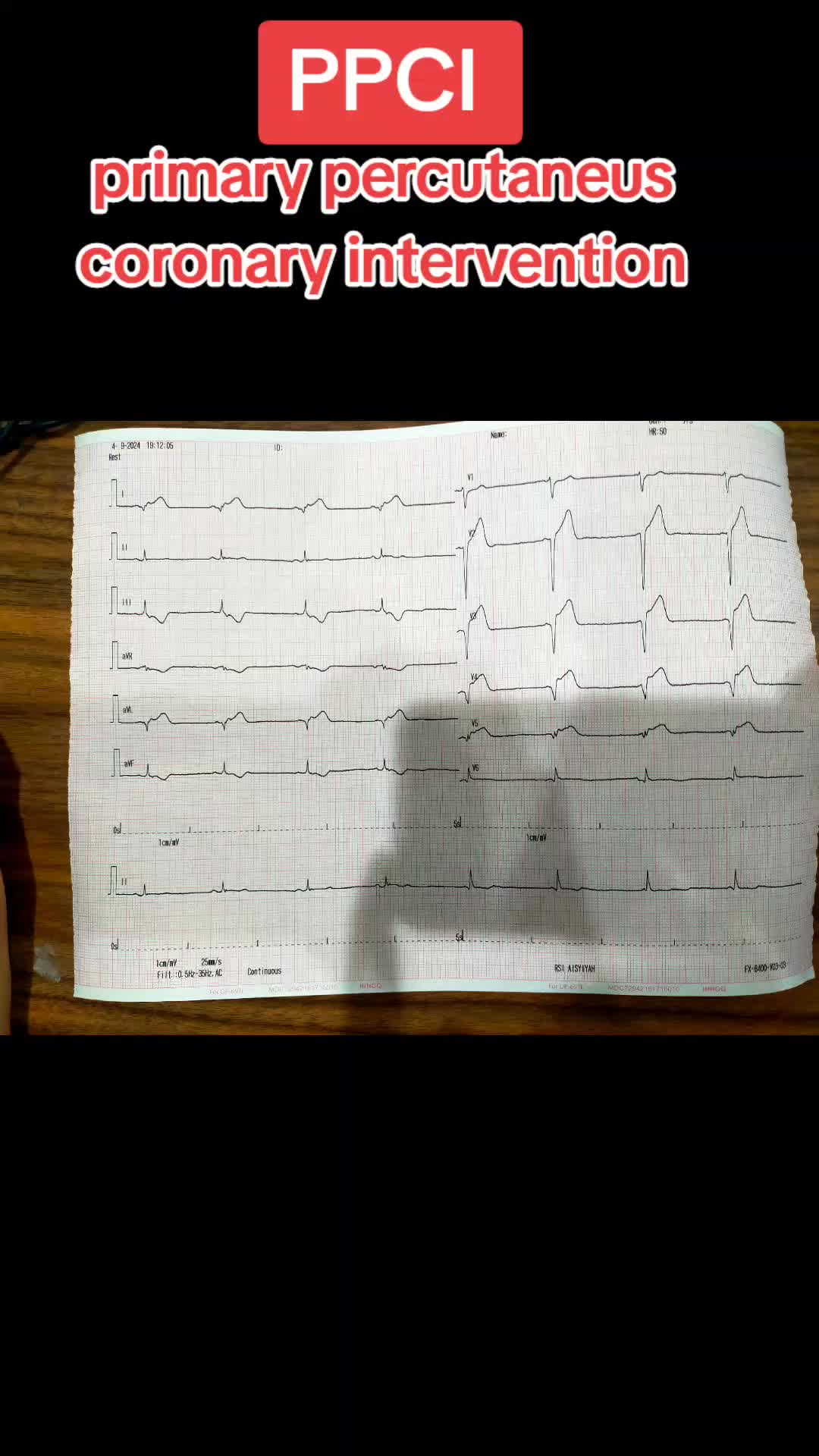 @Erlan A.P, MD
