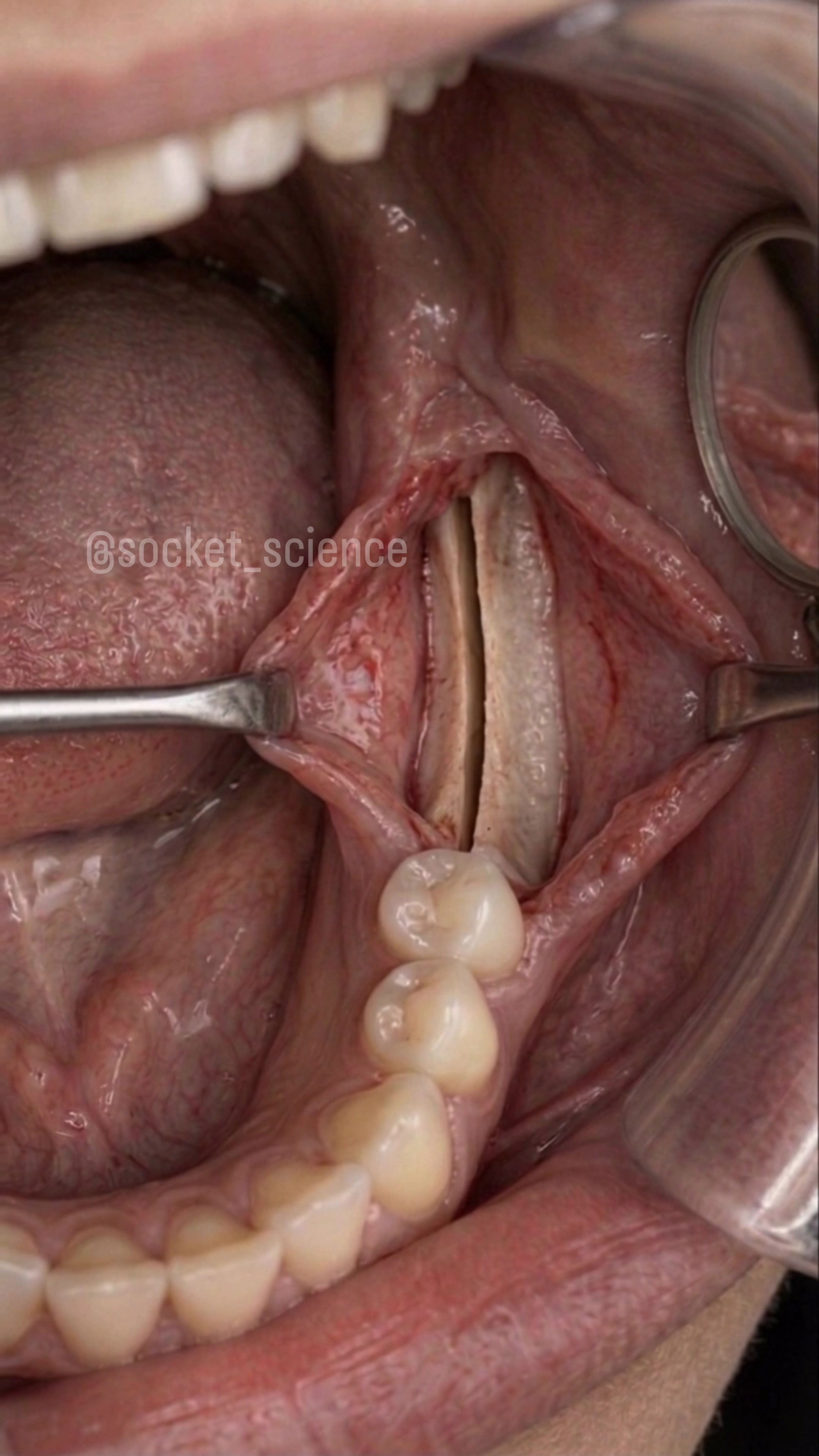 @Socket Science | Dental Visual