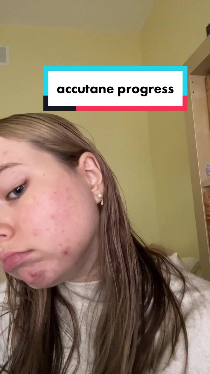 @AP