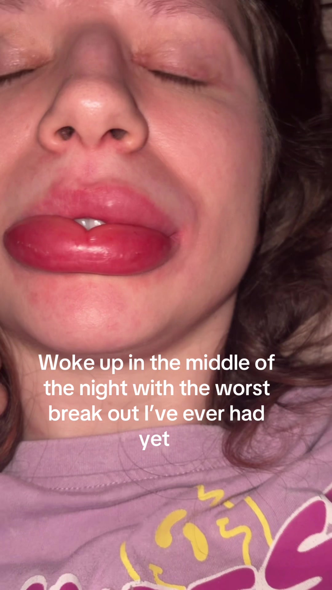 @Karolina