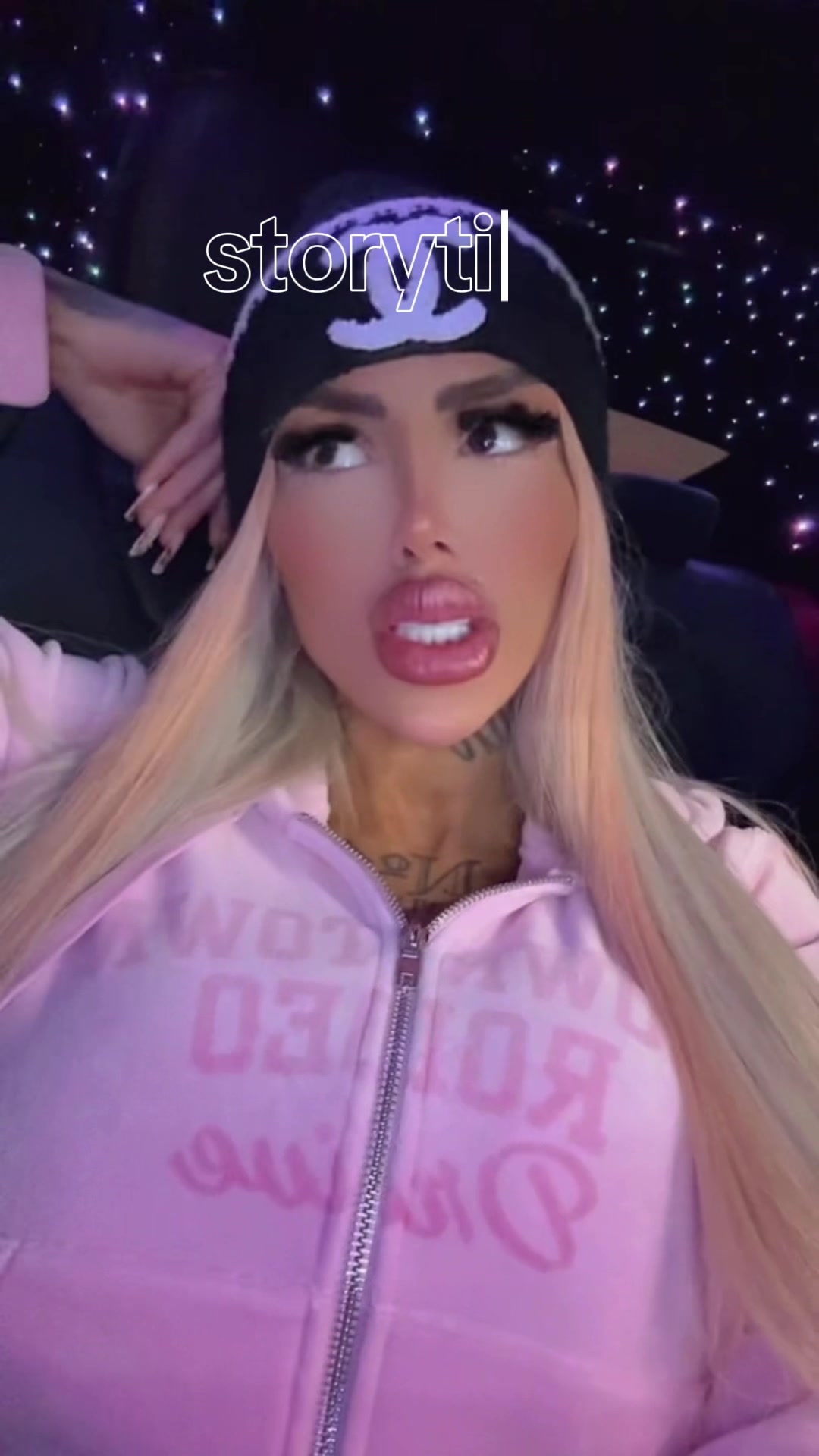 @GONI💎ICNBRB🖤