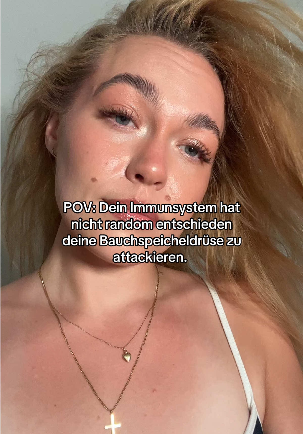 @cagivaa_t1d