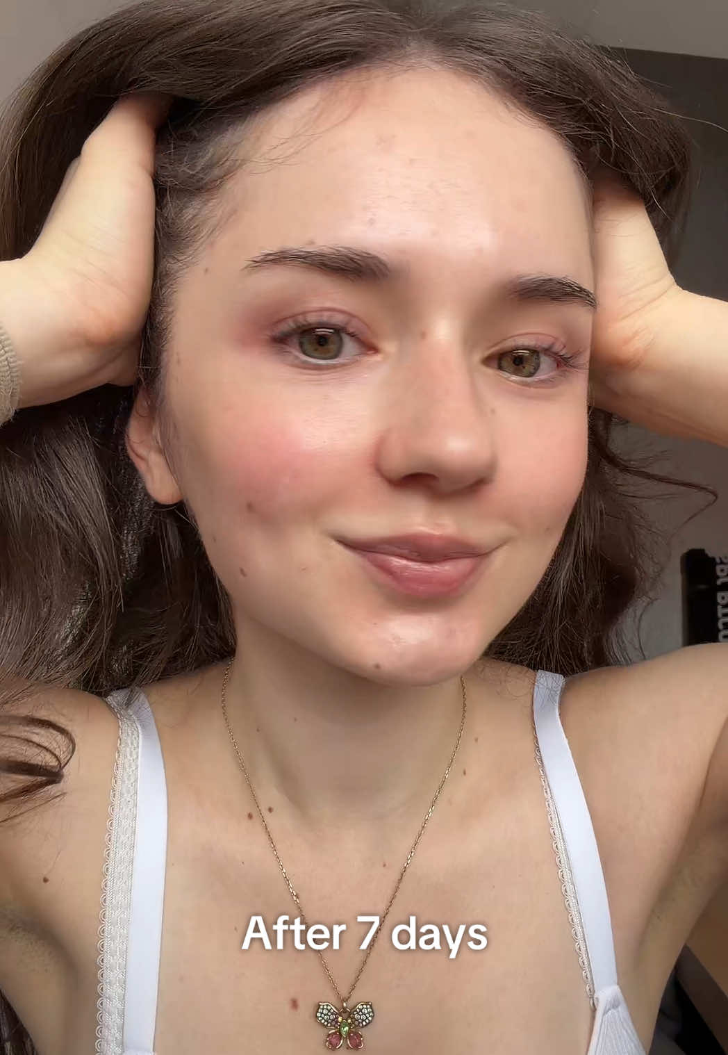 @australialix