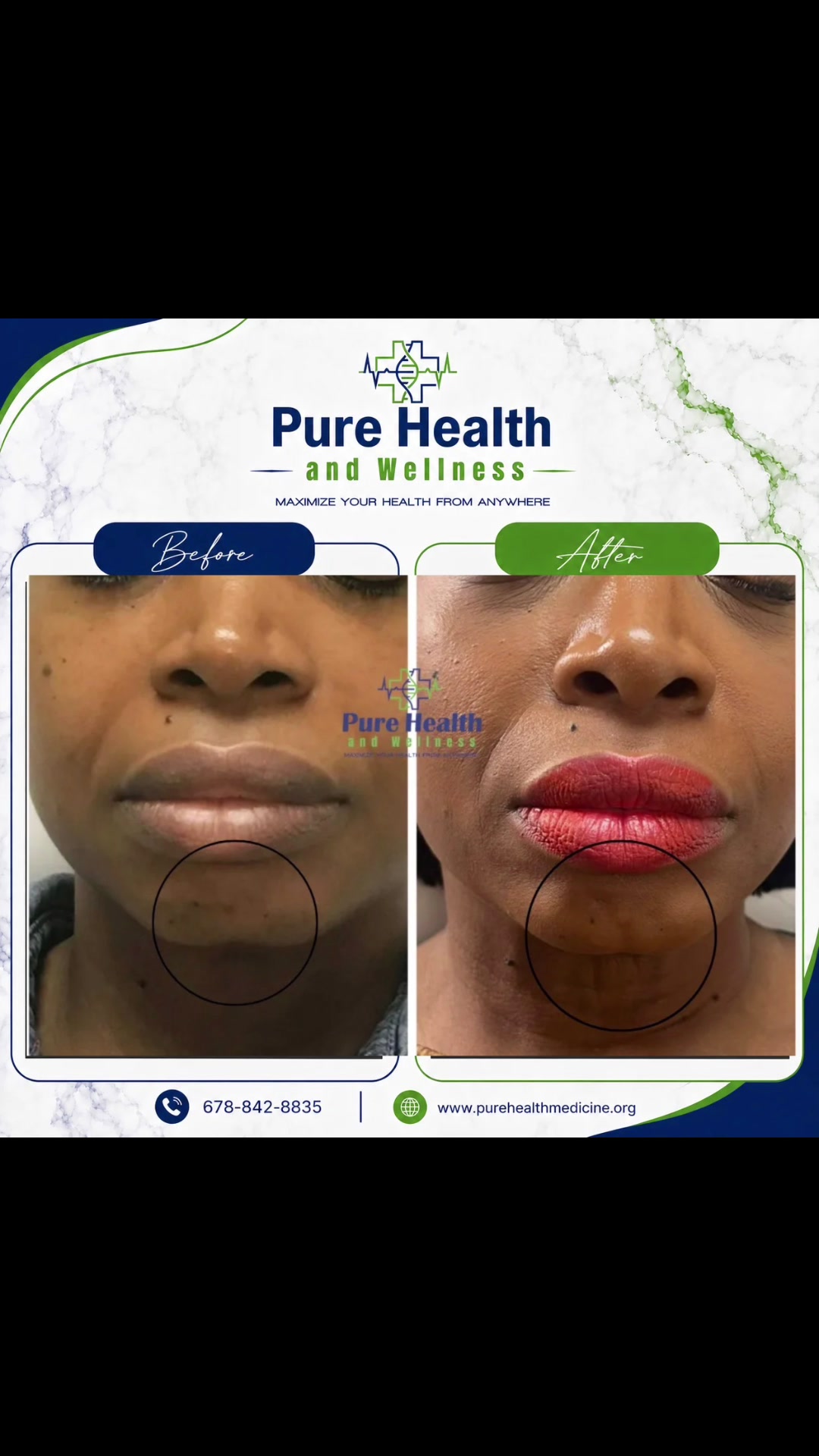 @PureHealthand_Wellness