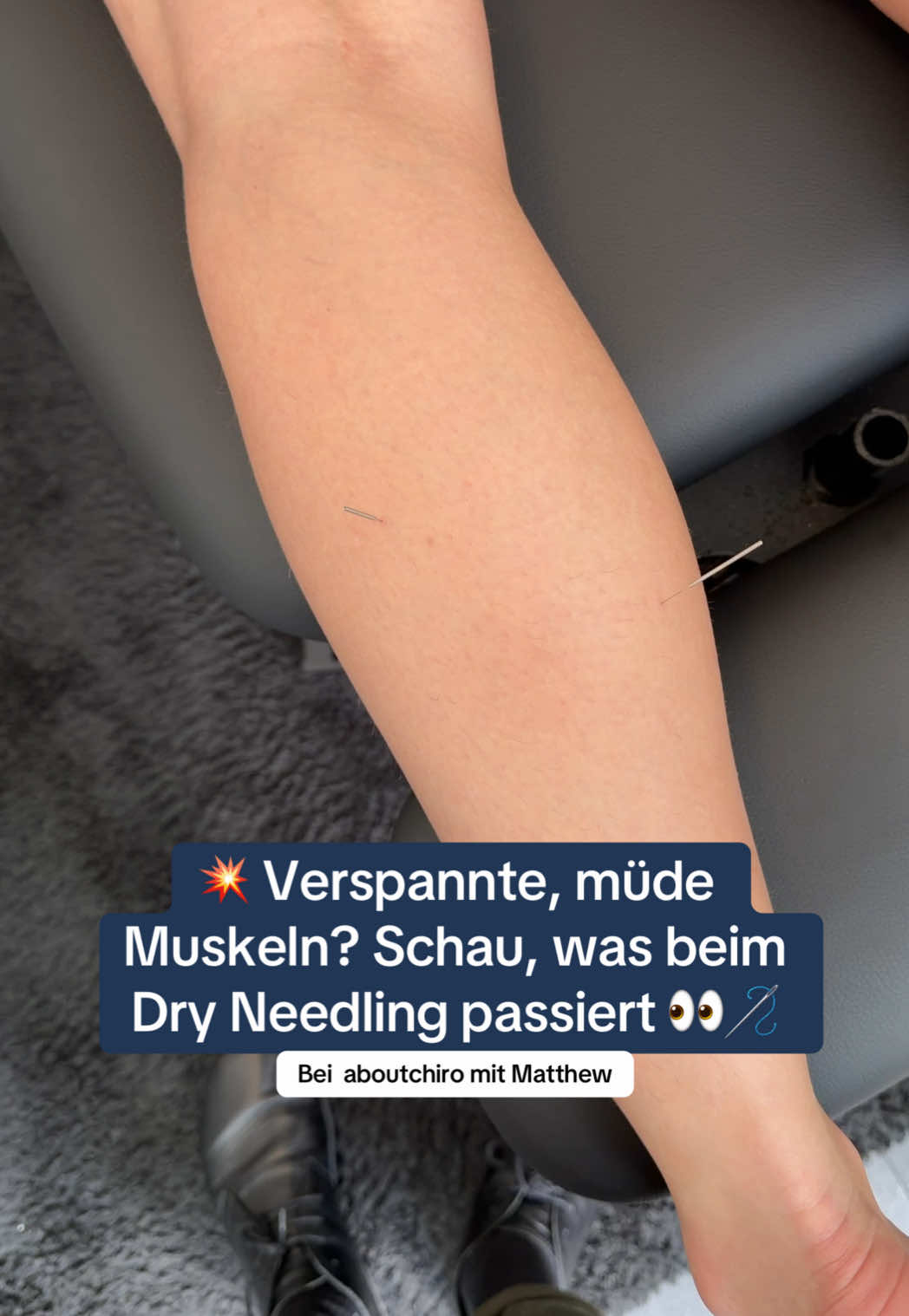 @aboutchiro