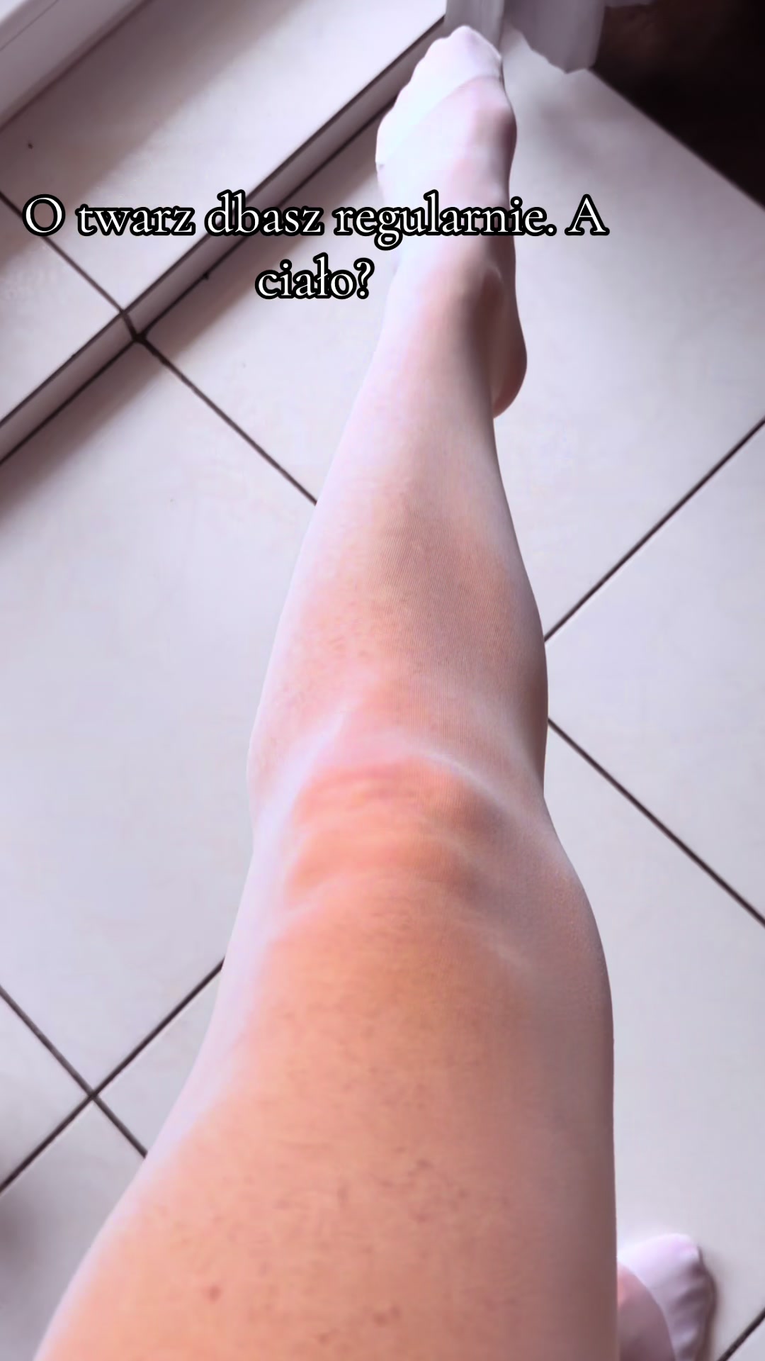 @Monika Sekita-Pilch