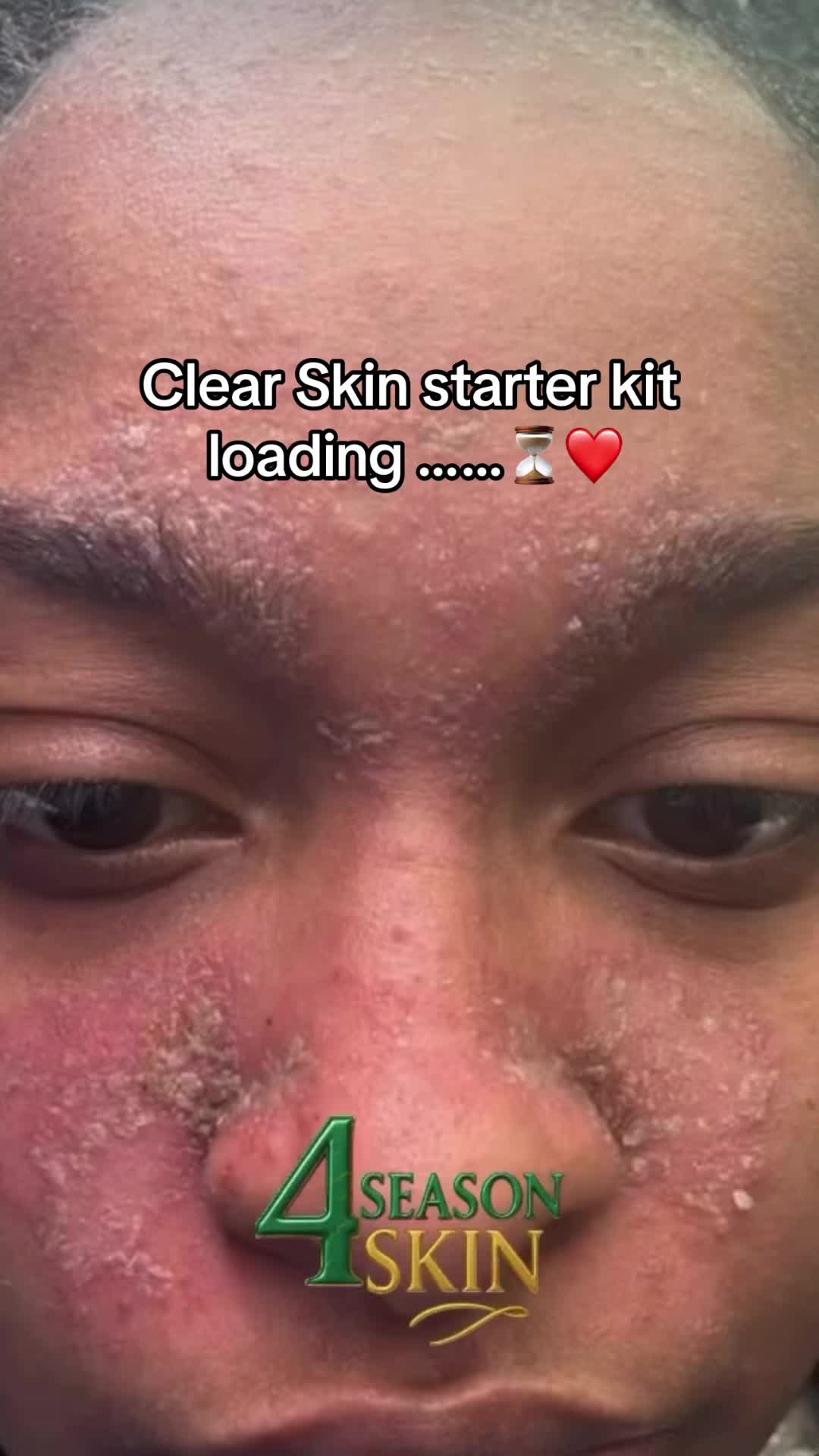 @4seasonskin