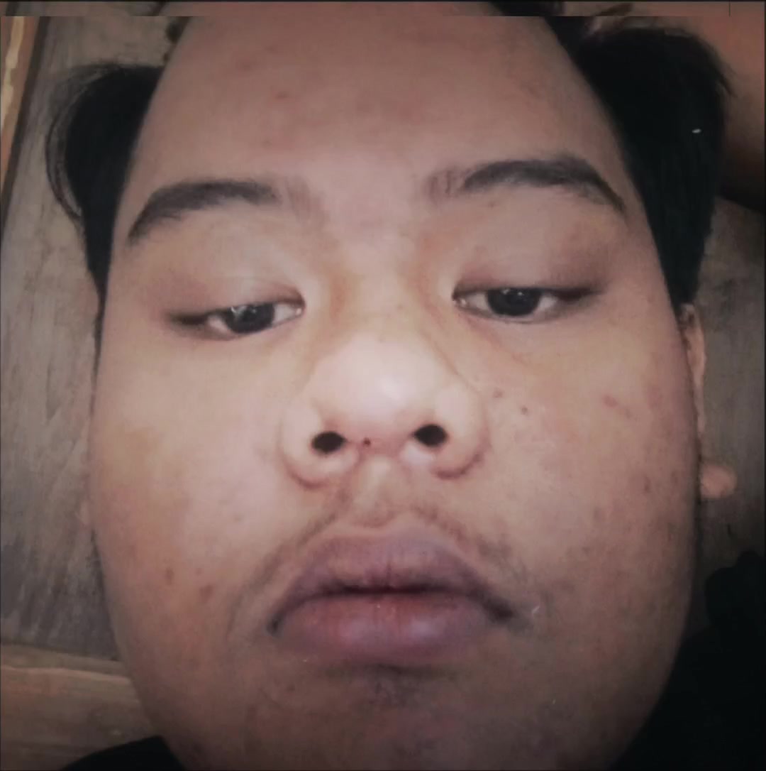 @505