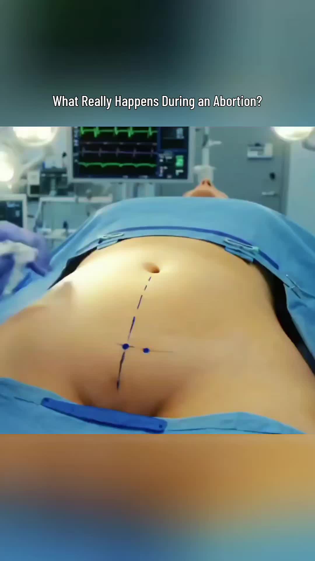 @Femniverse