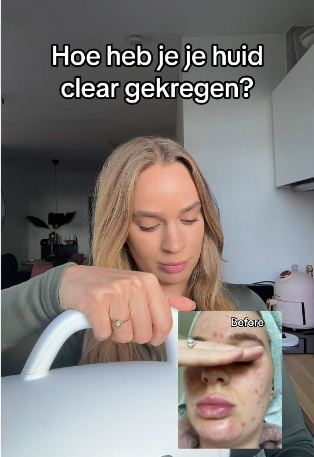 @Rebecca | Huidtherapeut✨