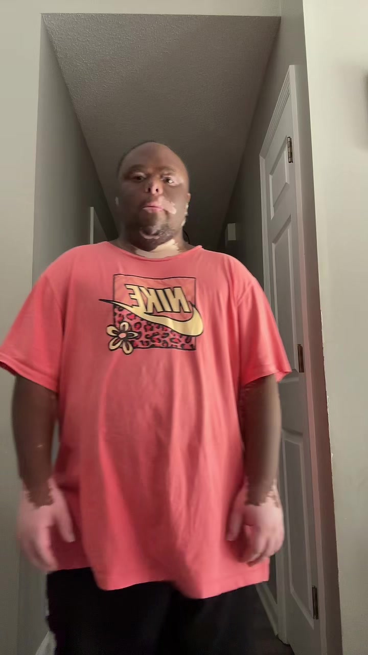 @Tre