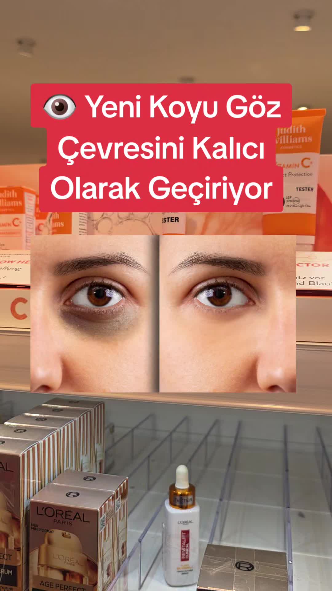@Gurbet Ana