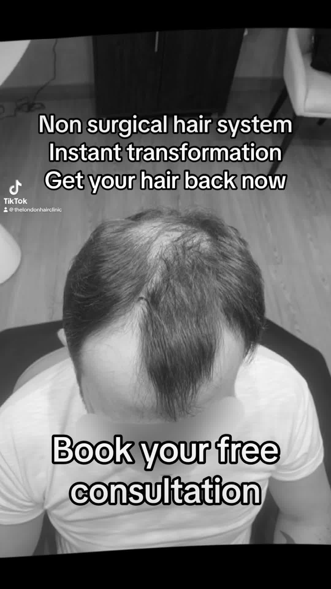 @TheLondonHairClinic