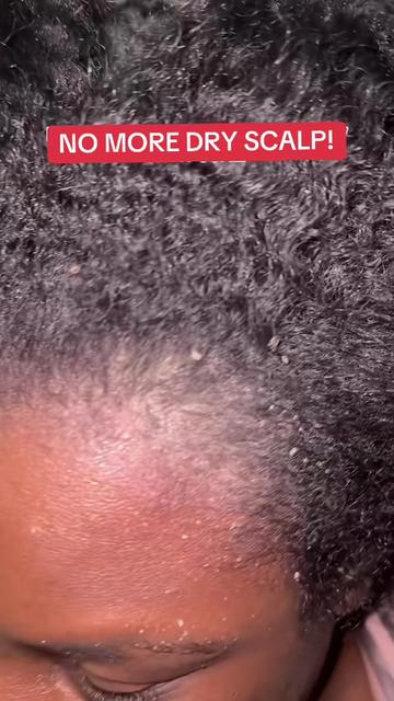 @Ebony✨Natural Hair & Fashion
