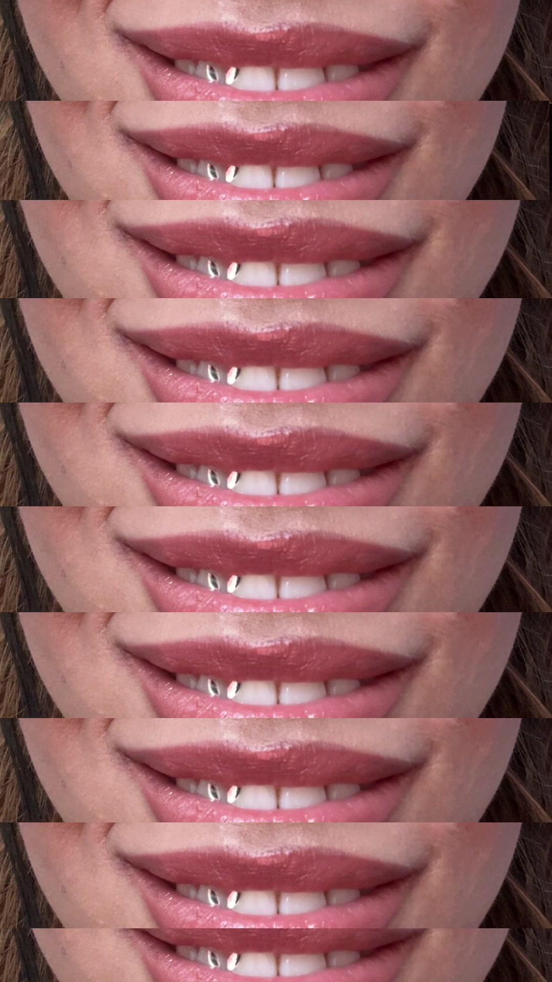 @777