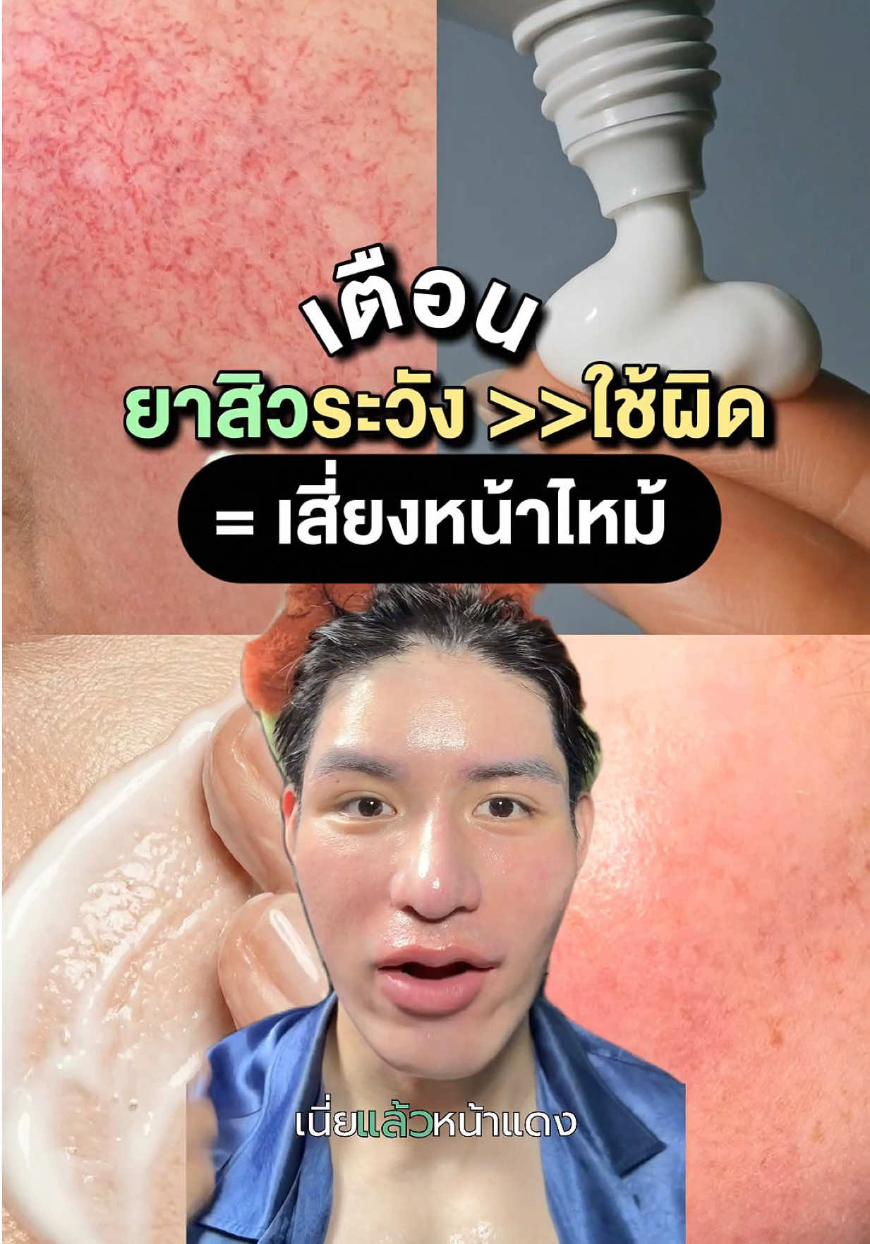 @หนูปอนด์ที่ชอบเลเซ่อร์