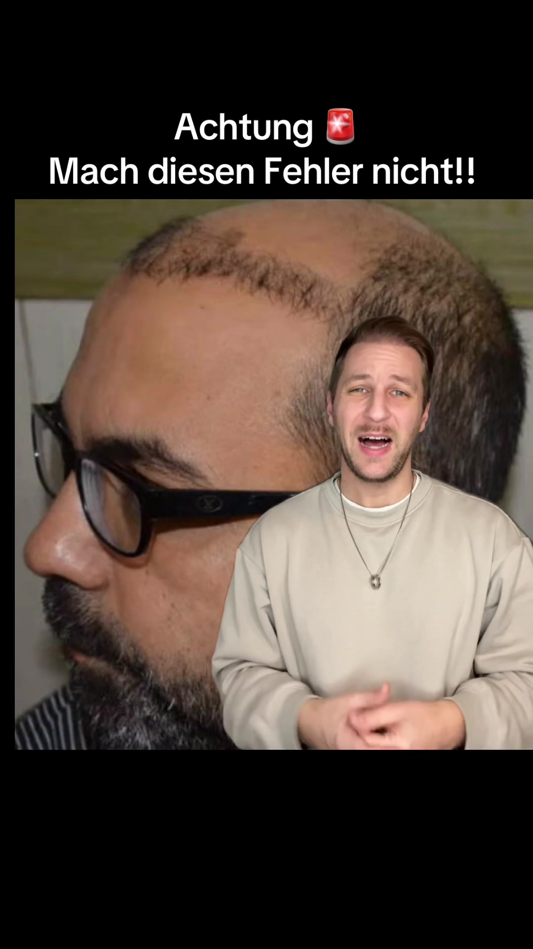 @Mr. Hairtransplant