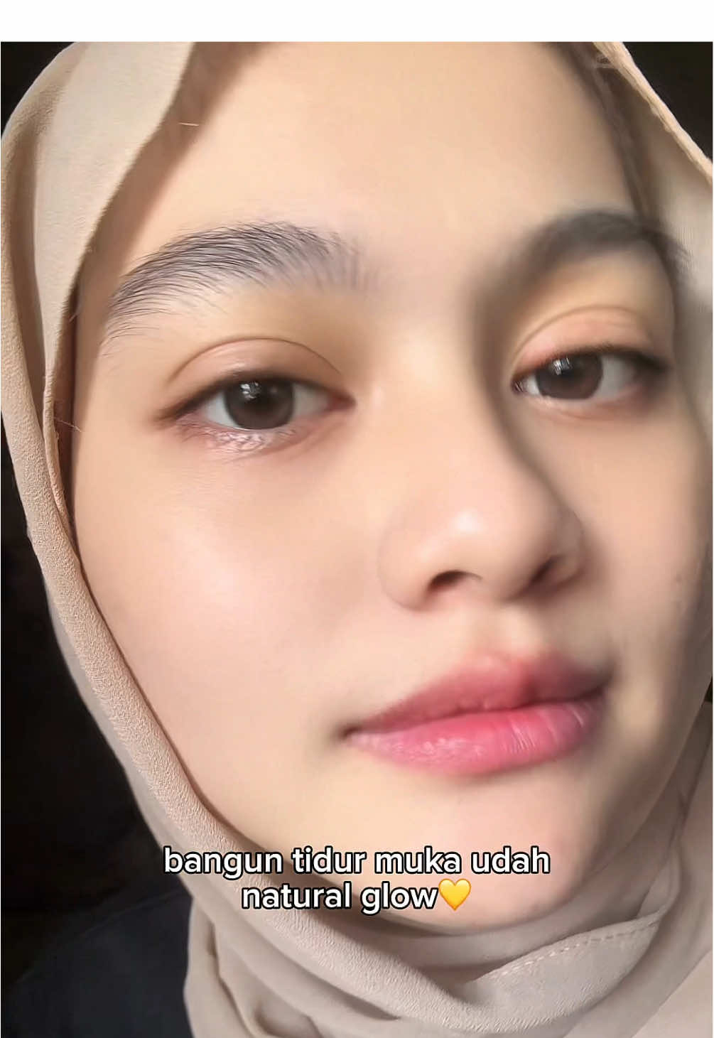 @ecaa