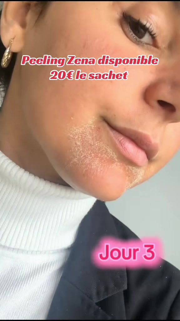 @peeling_zena