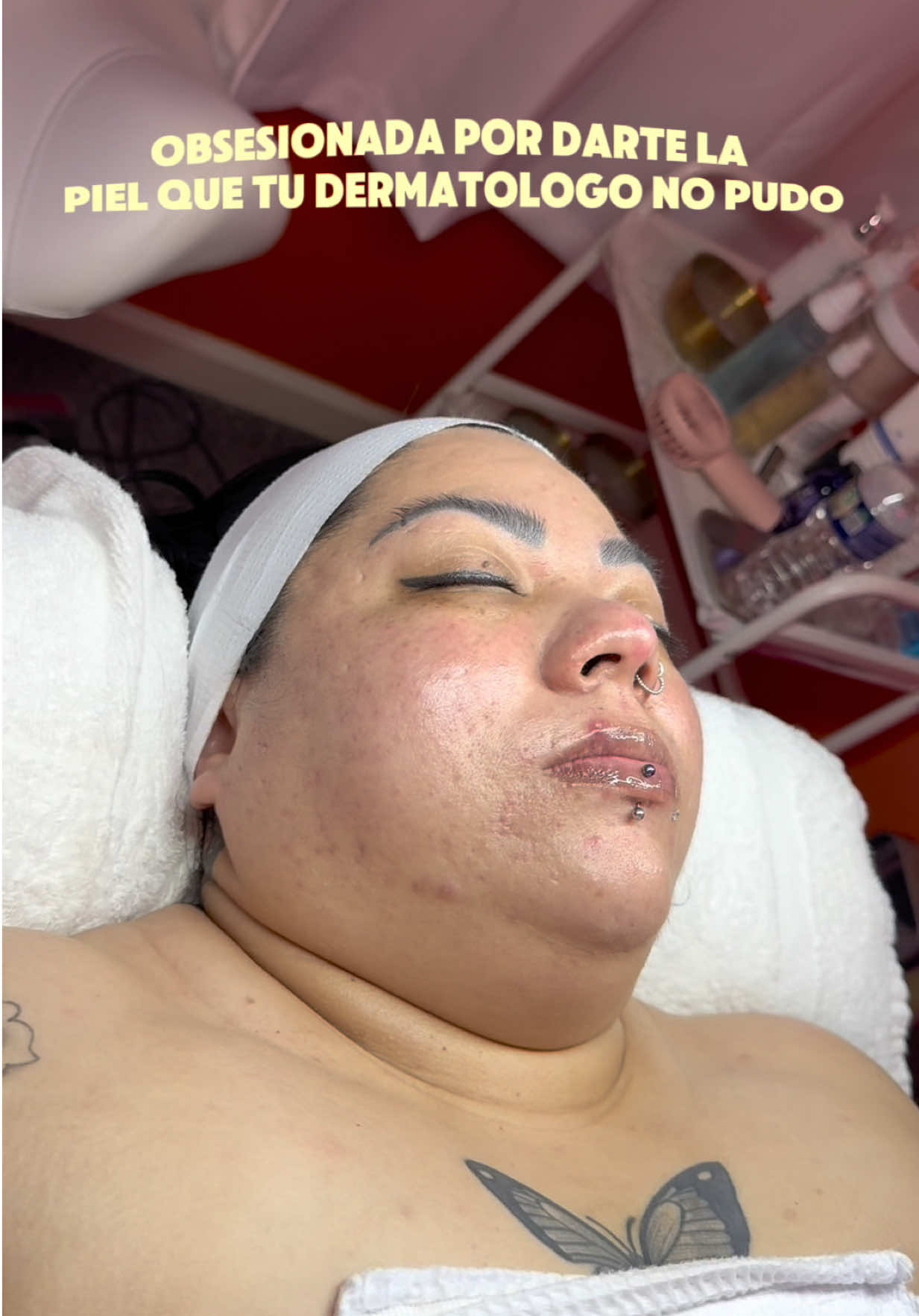 @HappySkinBySara