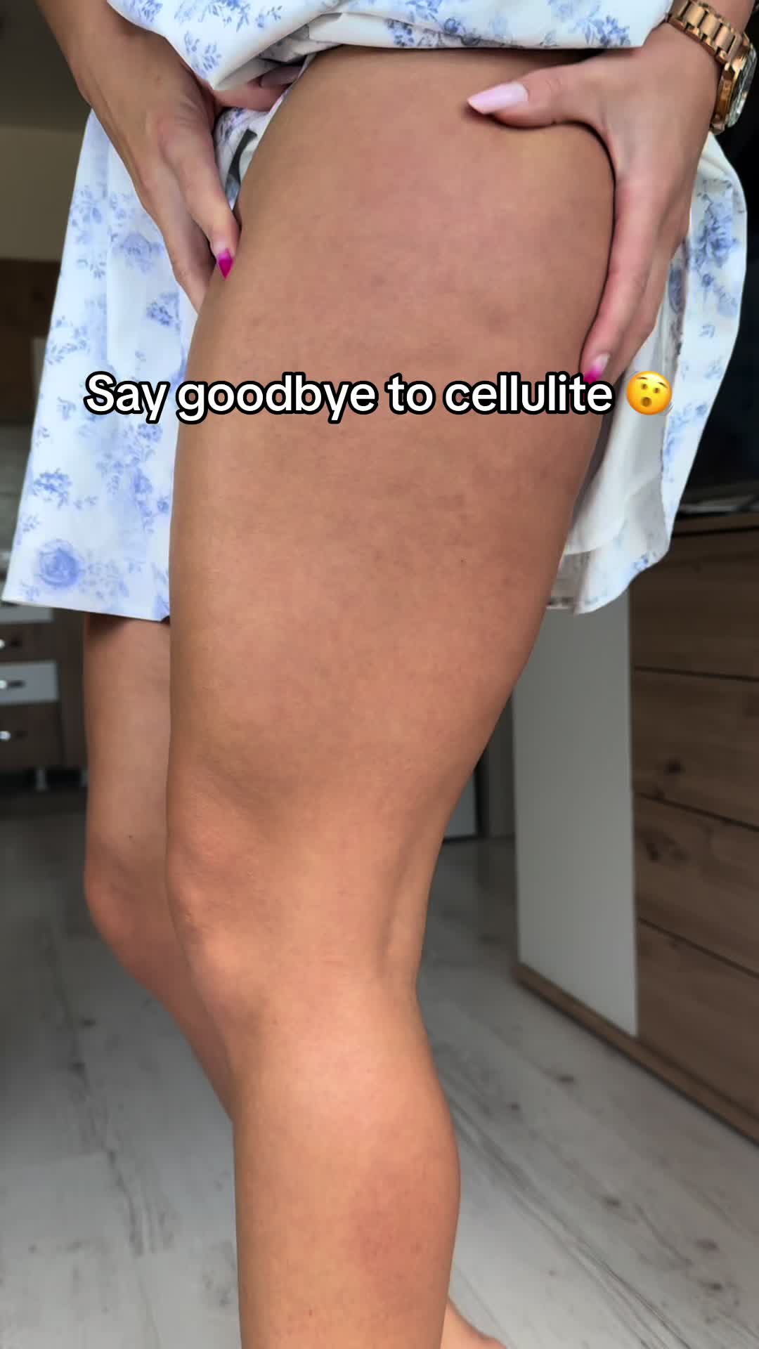 @CelluSnap