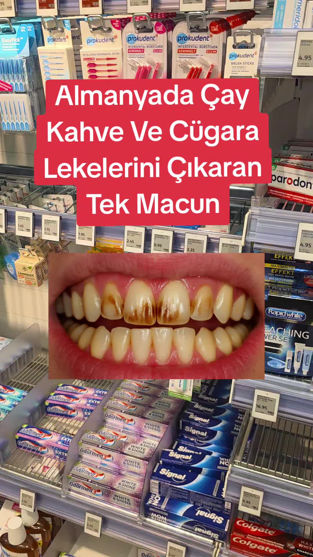 @Gurbetana27