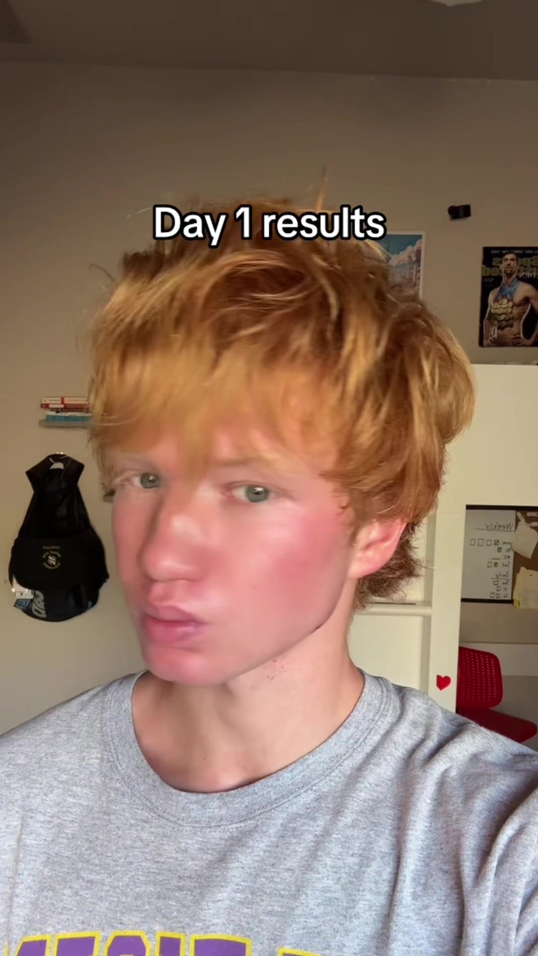 @Chann