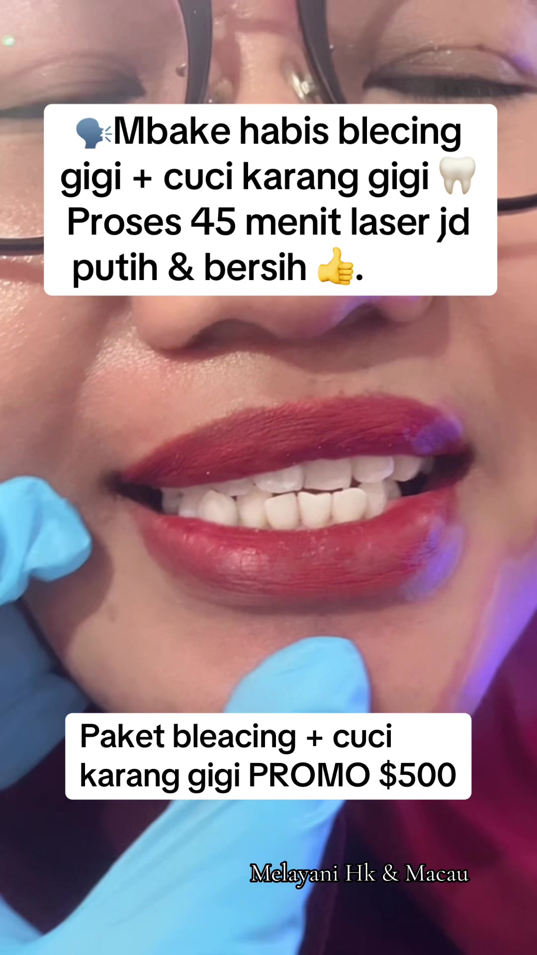 @mbak-Paijem