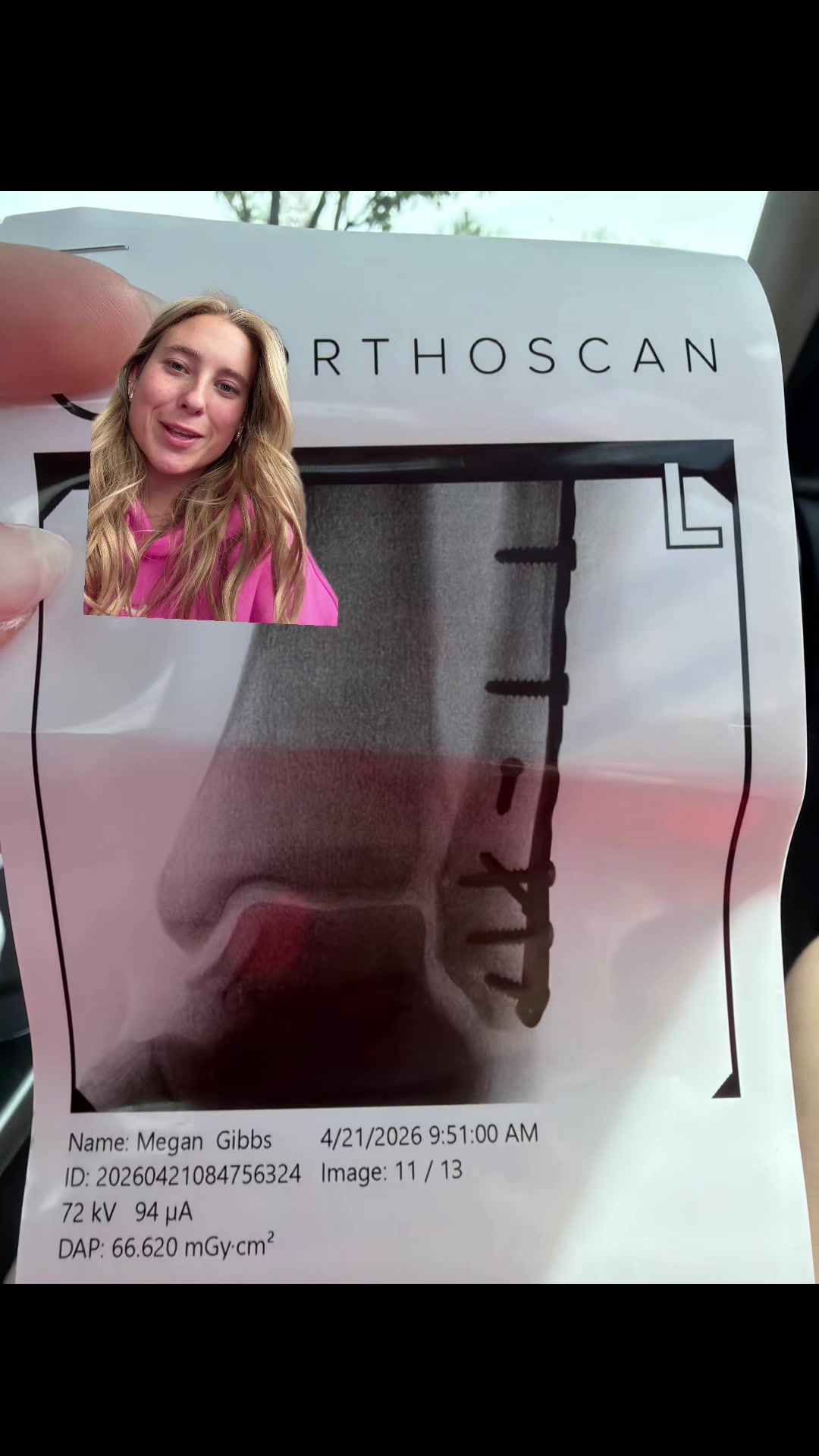 @megan