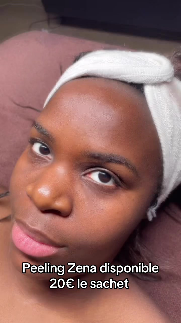 @peeling_zena