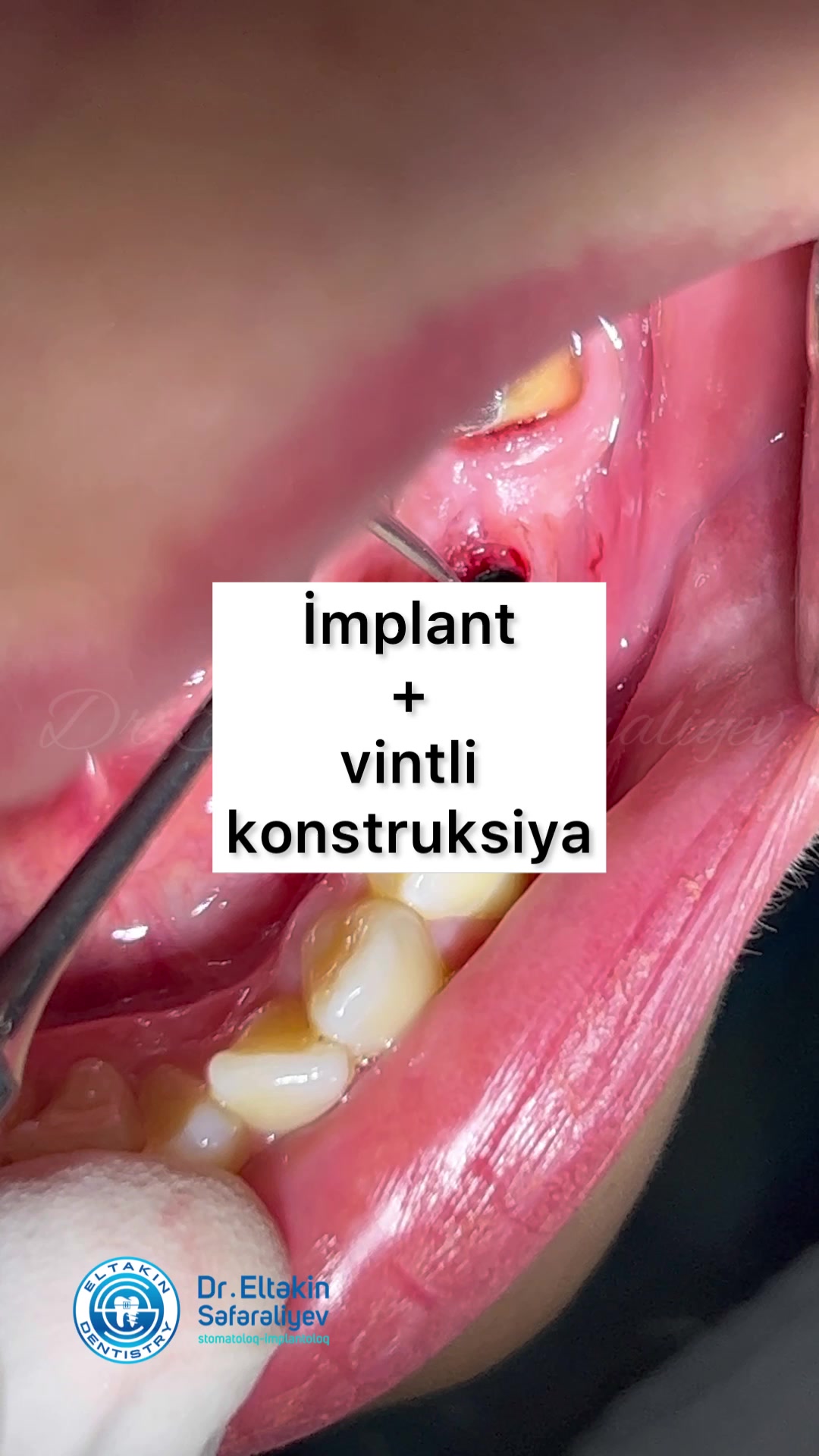 @eltakindentistry