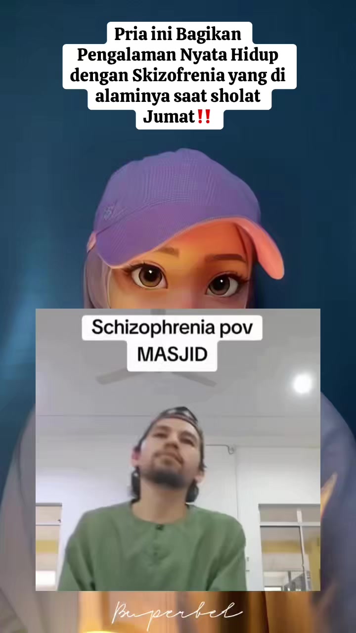 @B U P E R