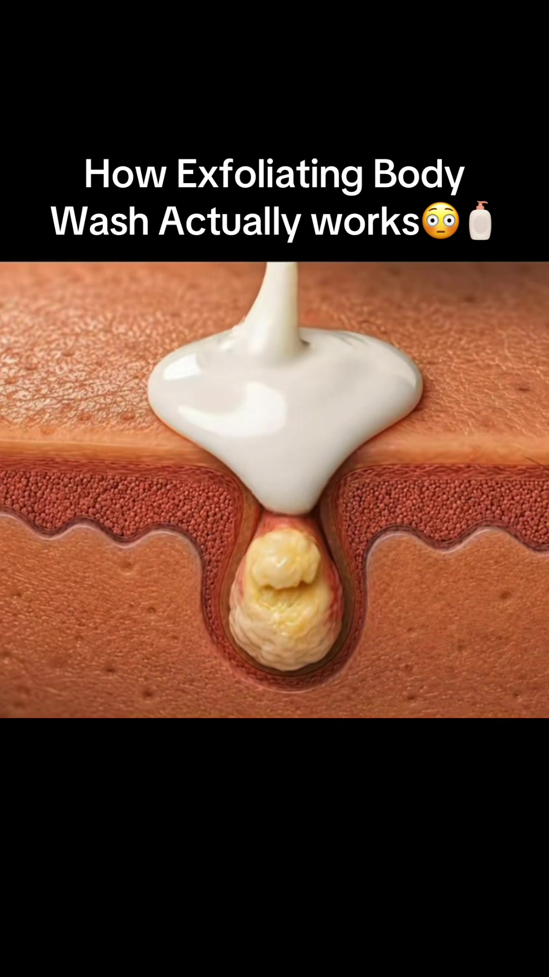 @…
