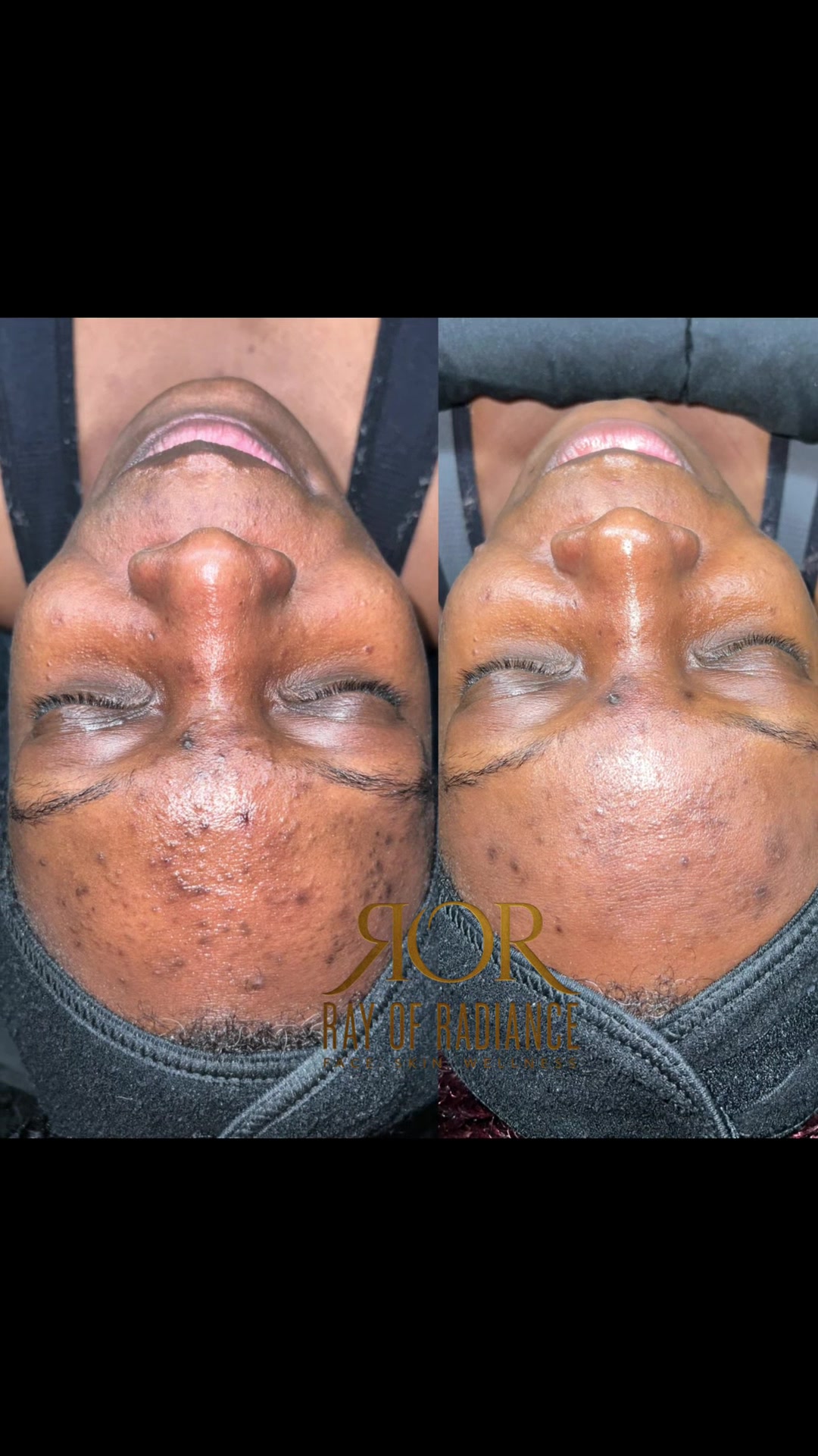 @Rosey-FL Esthetician/laserTech