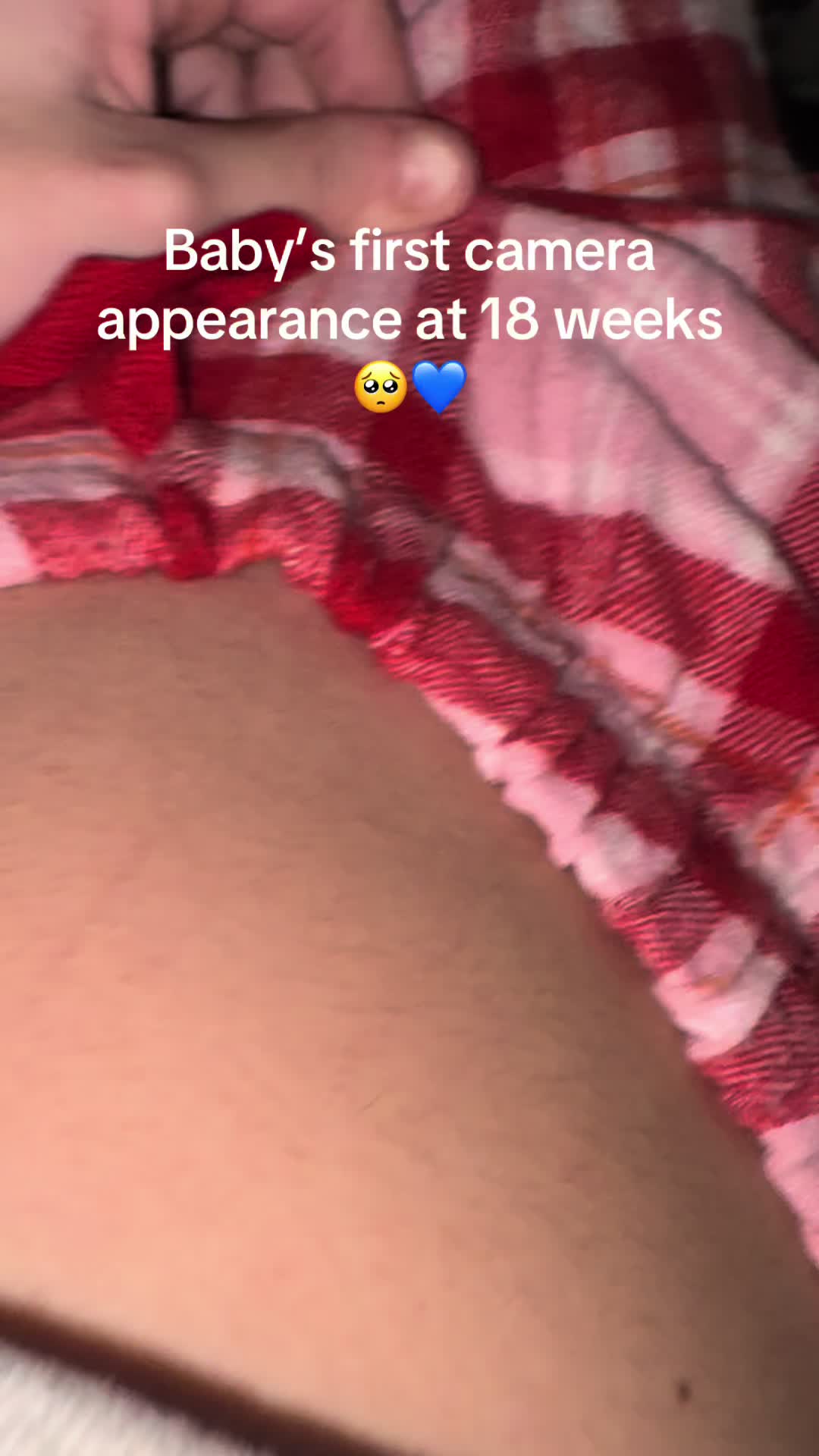 @S🎀