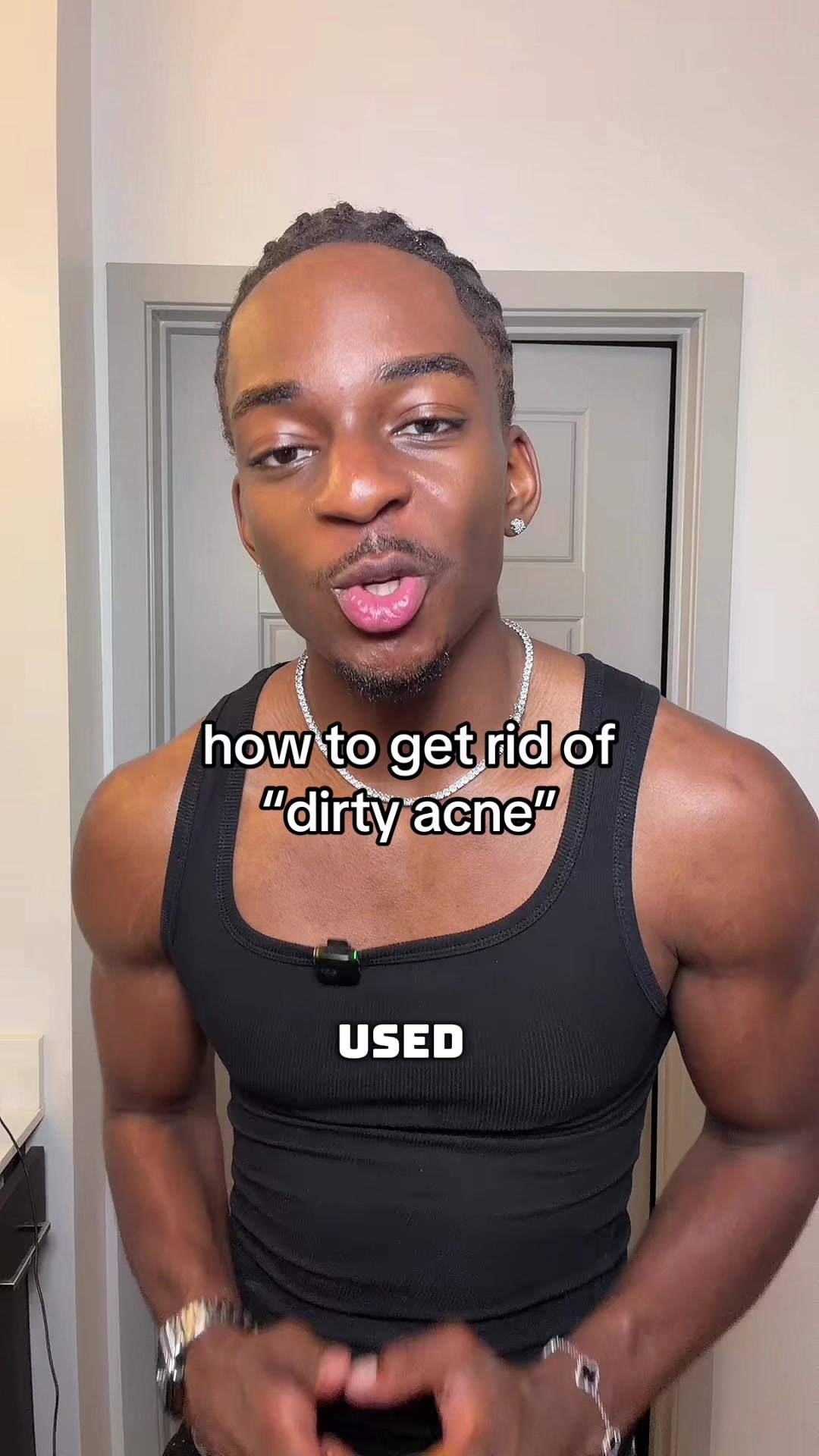 @BRANT