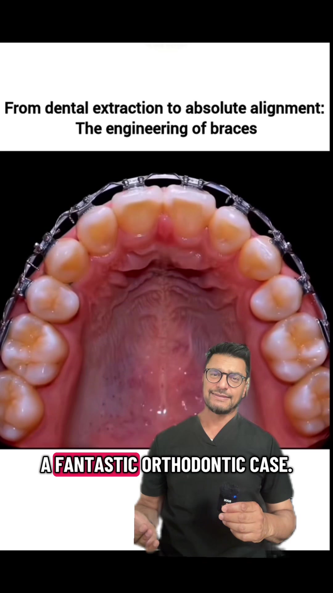 @Dentite
