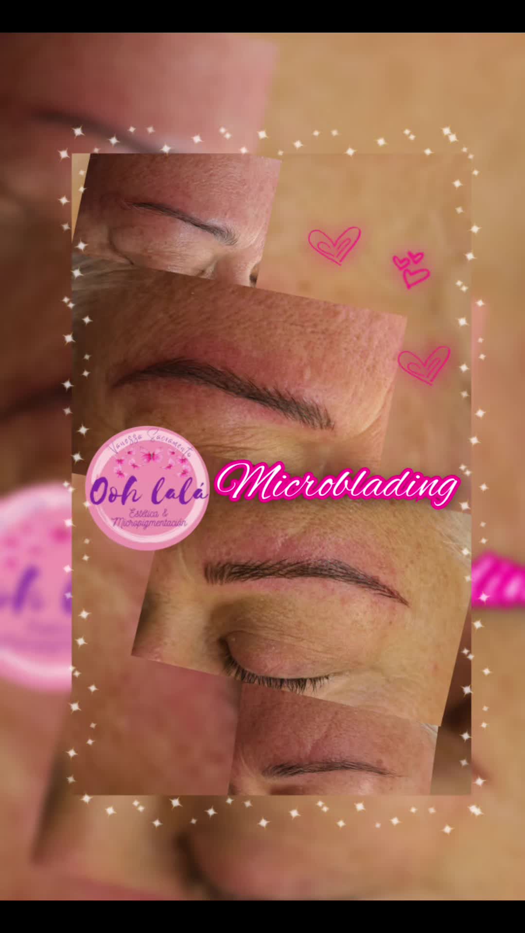 @Oohlal&aacute; Est&eacute;tic