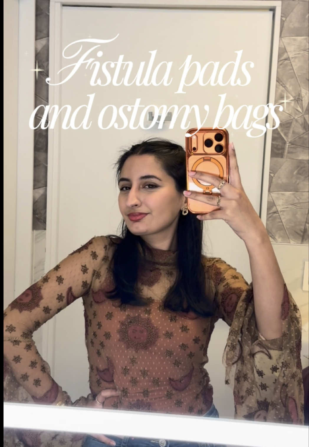 @ostomate
