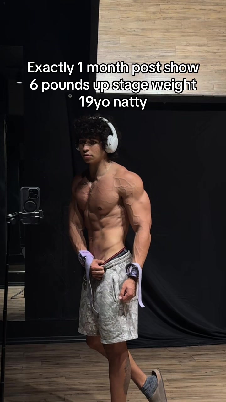 @casteticz
