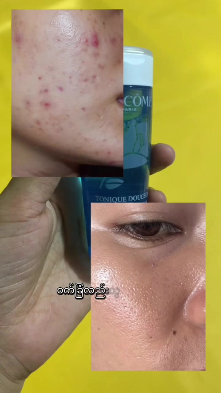 @Juneberry Cosmetics