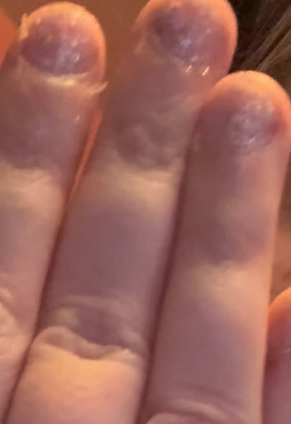 @kaitmaster