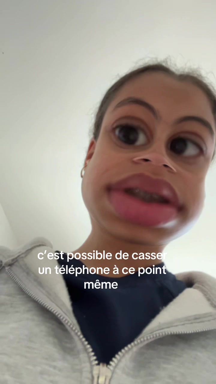 @Lol