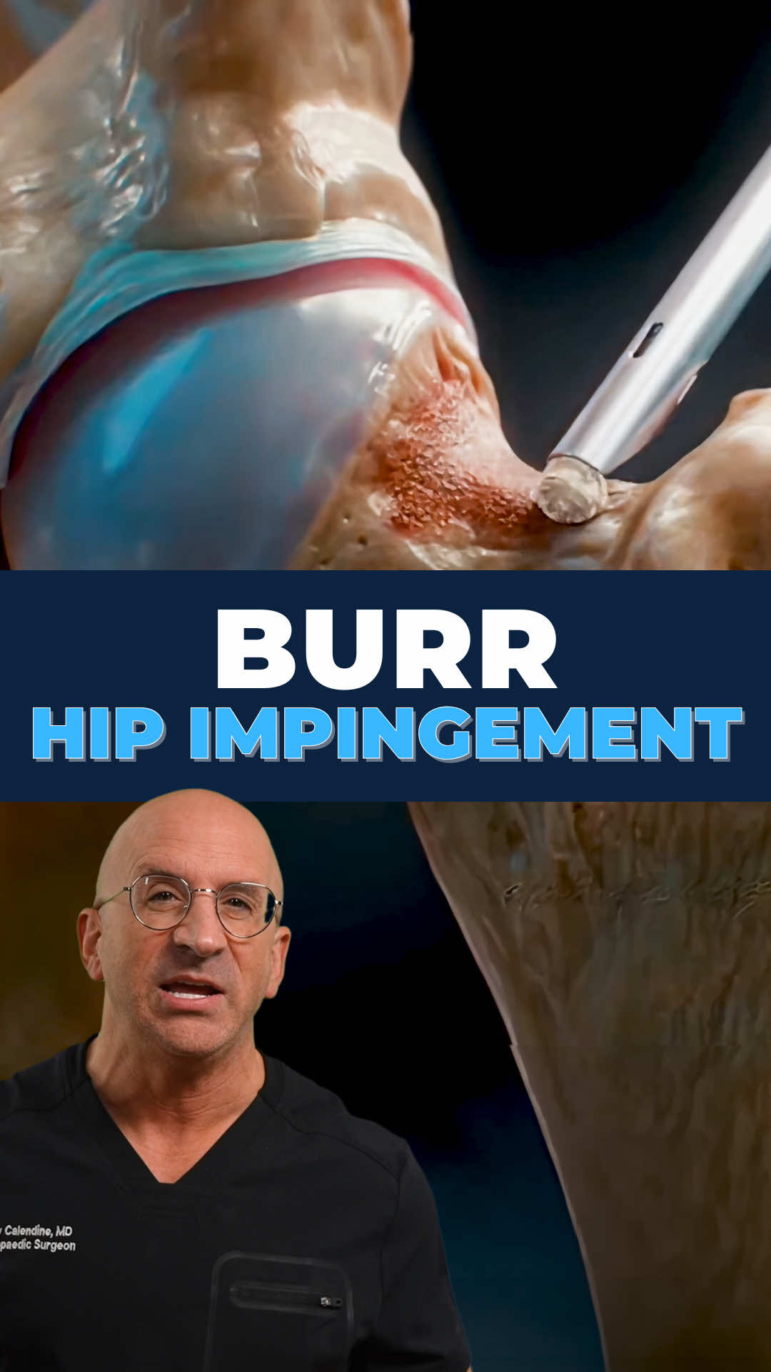@Bone Doctor - Joint Pain MD